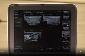 tutoriel échographe samsung HM70EVO rapport