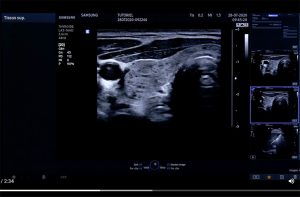 Tutoriel échographe Samsung HS40 2D