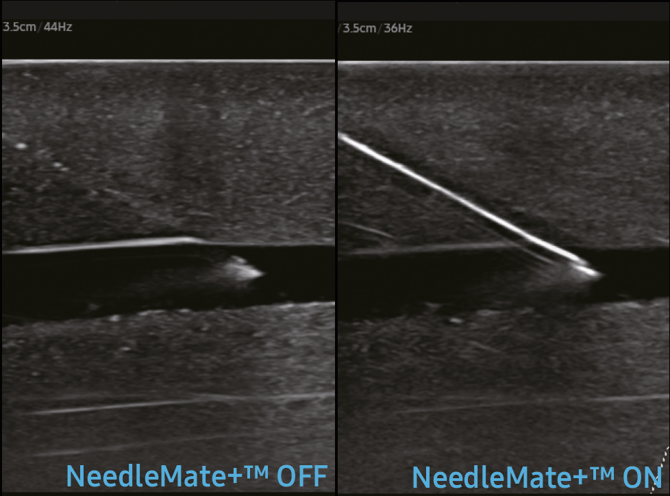 Needle Mate+ sur échographe portable Samsung HM70 EVO