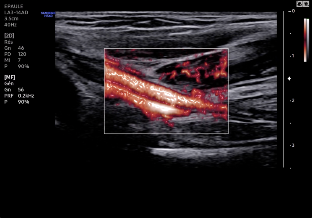 Echographe Samsung HS60 MV Flow