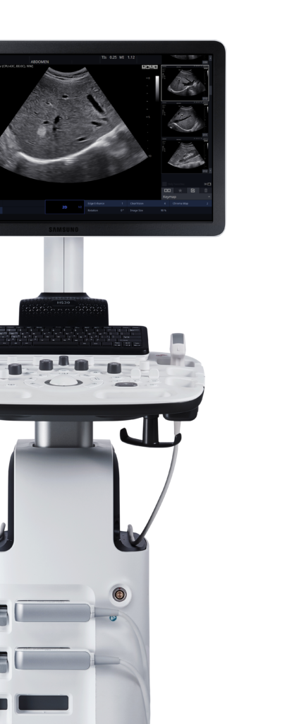 Echographe Samsung HS30 demi face