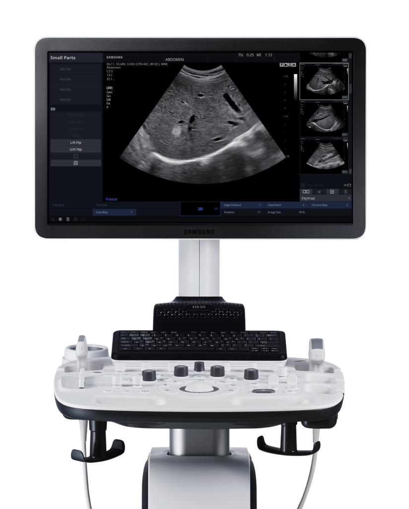 Echographe Samsung HS30 vue face