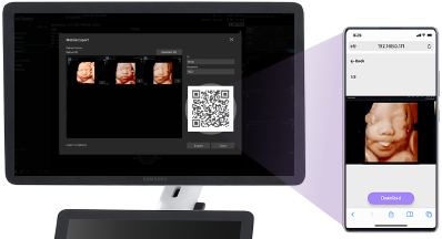 Echographe Samsung HERA I10