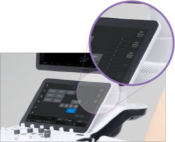 Echographe Samsung HERA I10