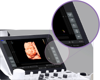 Echographe Samsung HERA I10