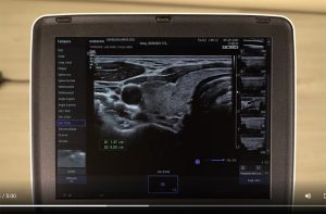 Tutoriel échographe Samsung HM70EVO mesures