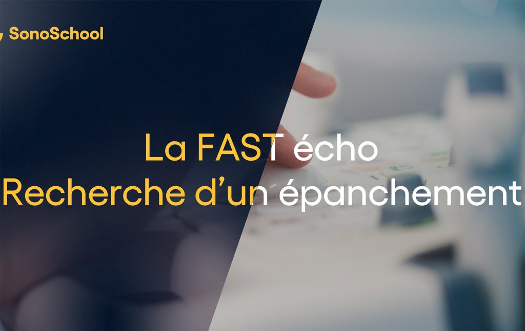 FAST echo formation échographie en ligne sonoschool