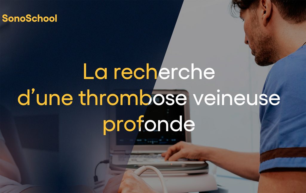 échographie thrombose formation échographie sonoschool