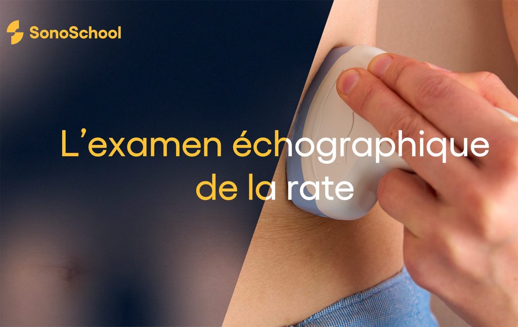 échographie de la rate formation en ligne sonoschool