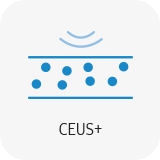 Echographe samsung v7 CEUS+