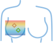 Echographe samsung v7 E-Strain
