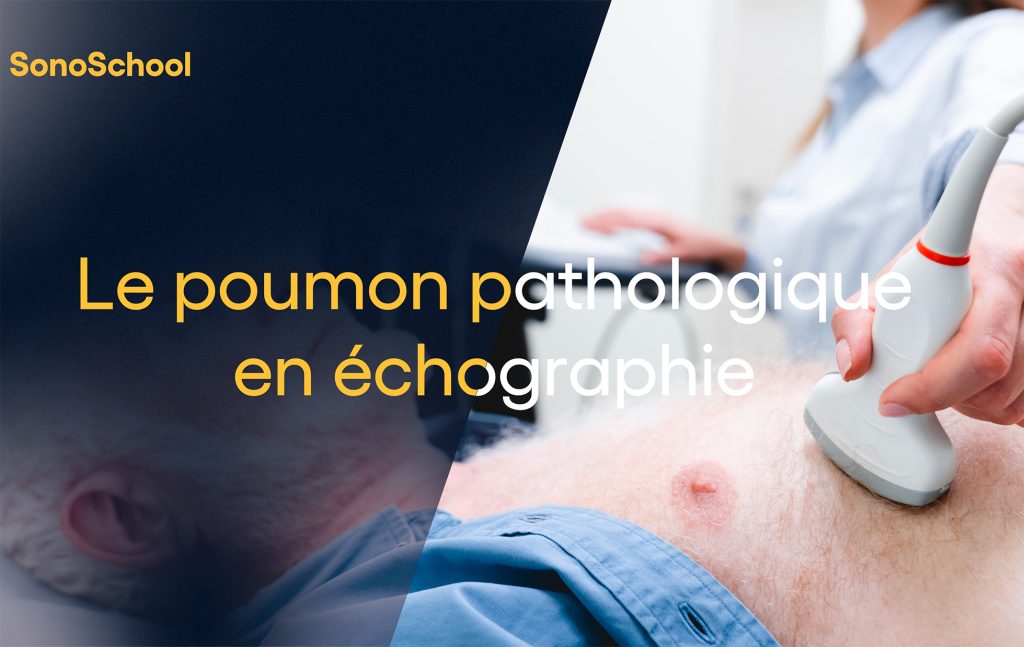 formation échographie poumon pathologies pulmonaires sonoschool isonic