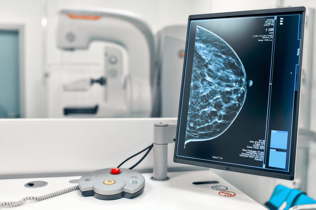 dépistage cancer du sein mammographie