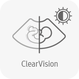 echographe samsung V7 clearvision