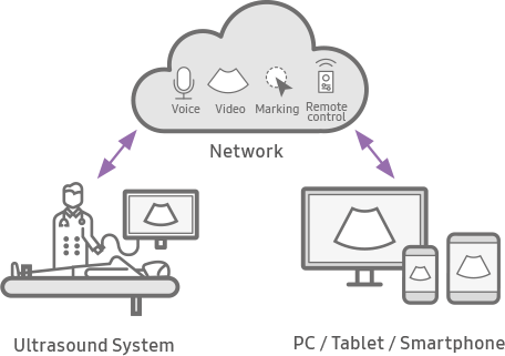 echographe samsung V7 sonosync