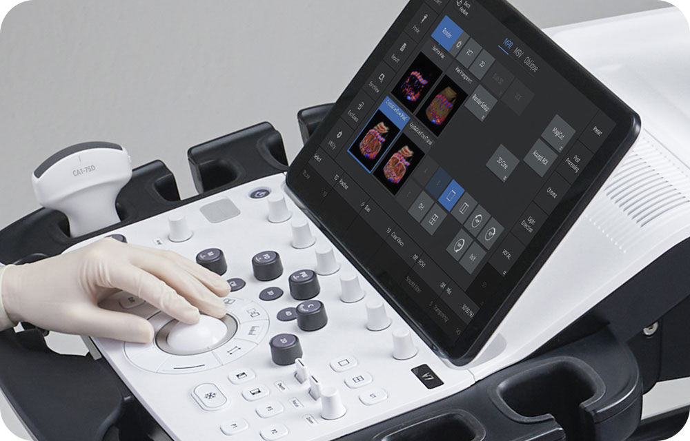 echographe samsung V7 obstetrique ergonomie