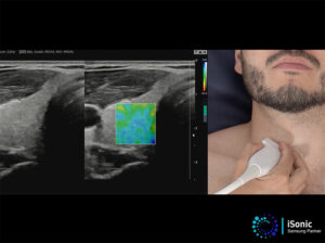 Échographes Samsung Elastoscan