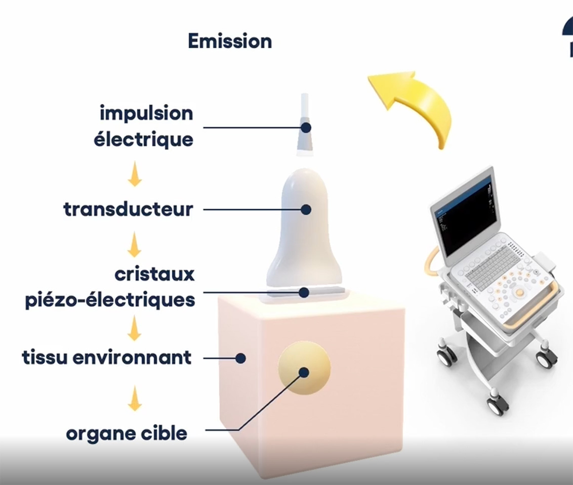 emission sonde echographie