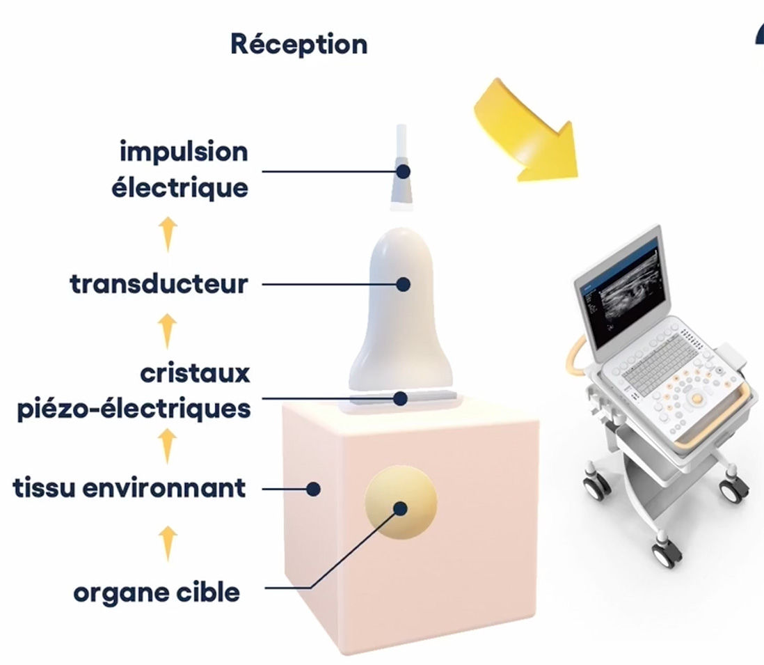 reception sonde echographie