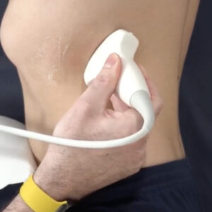 sonde echographie
