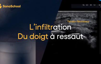 infiltration doigt sous echographie jimmy gross sonoschool