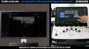 tutoriel echographie samsung V7 mode panoramique
