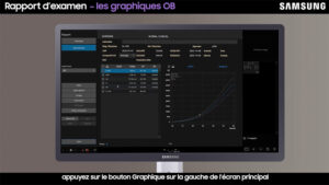 tutoriel echographie samsung V7 rapport d'examen