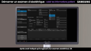 tutoriel echographie samsung v7 obstetrique demarrer un examen