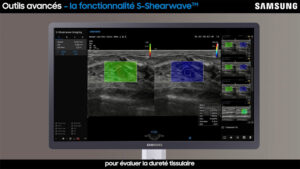 tutoriel echographie shearwave samsung V7