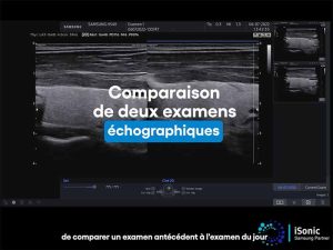 ez_compare_comparaison_examens_echographiques_samsung