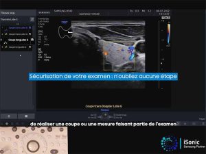 ez_exam_protocole_examen_echographie_samsung