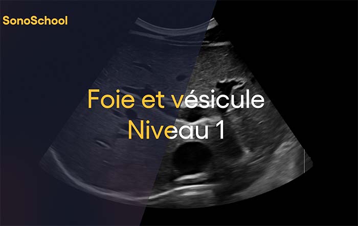 formation_echographie_abdominale_sonoschool
