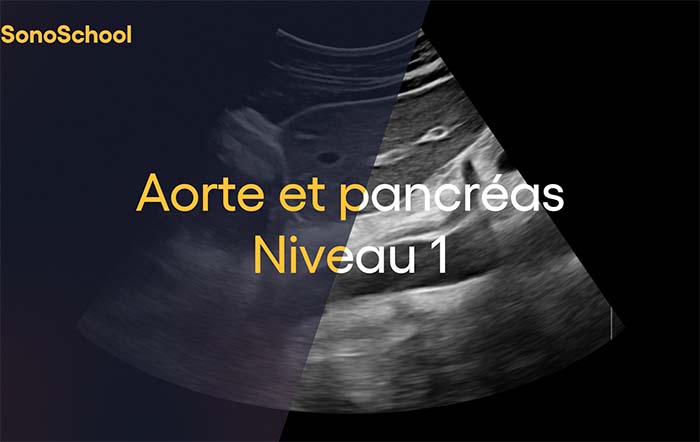 formation_echographie_aorte_pancreas_sonoschool