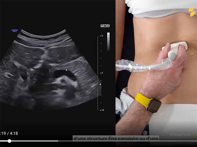 formation_echographie_du_pancreas_sonoschool
