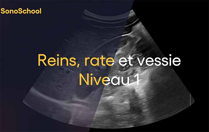 formation_echographie_reins_sonoschool