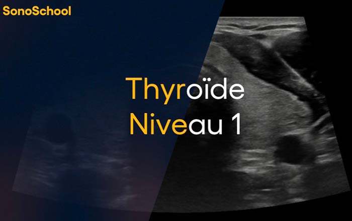 formation_echographie_thyroide_sonoschool