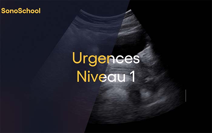 formation_echographie_urgences_sonoschool