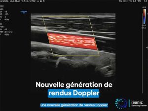doppler_3d_lumiflow_echographes_samsung