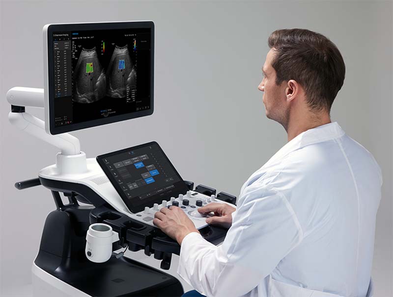 echographe_samsung_v6