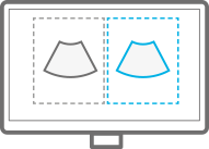 echographe_samsung_v6_ez_compare
