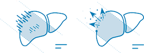 echographe_samsung_v6_tai_tsi_isonic