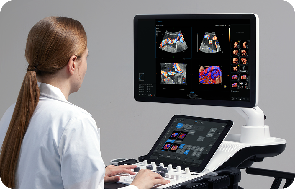 echographe_gynecologie_samsung_v6