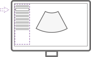 img_EzExam_echographe_samsung_v6_gynecologie_obstetrique