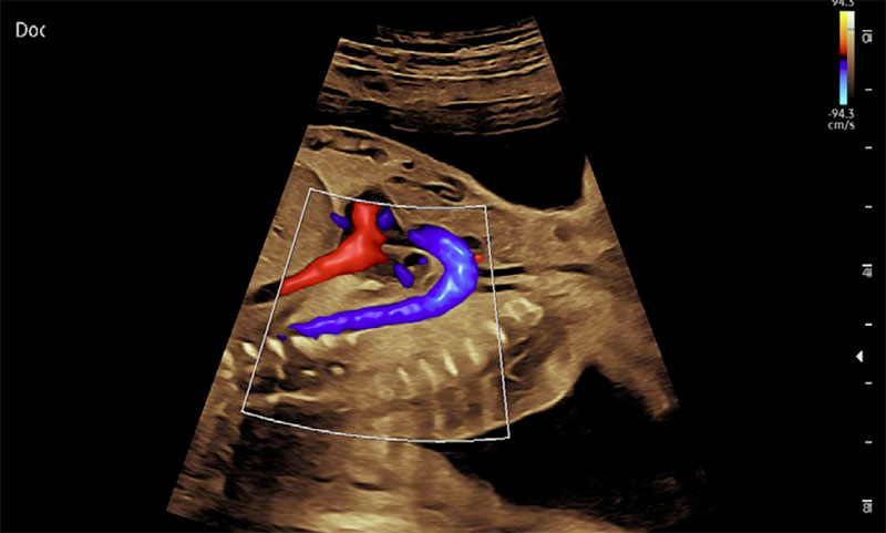 lumiflow_echographe_samsung_v6_gynecologie_obstetrique