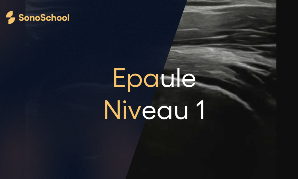 formation_echographie_epaule_sonoschool