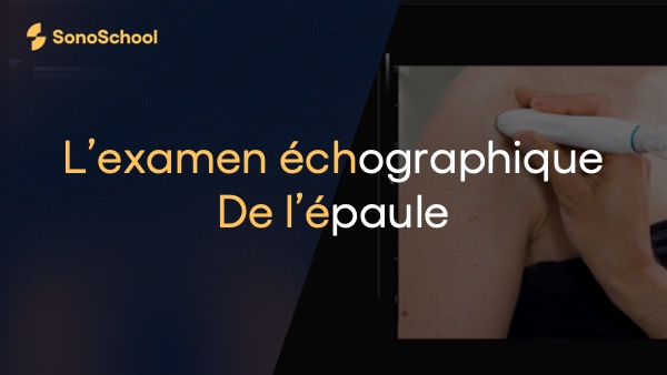examen_echographique_epaule_sonoschool