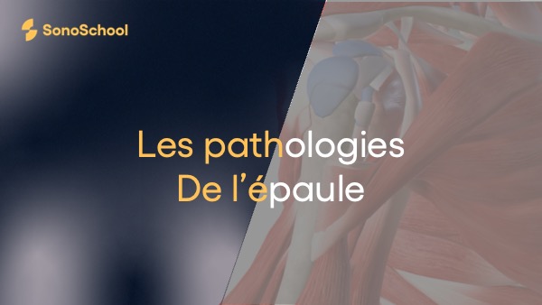 pathologies_epaule_echographie_sonoschool
