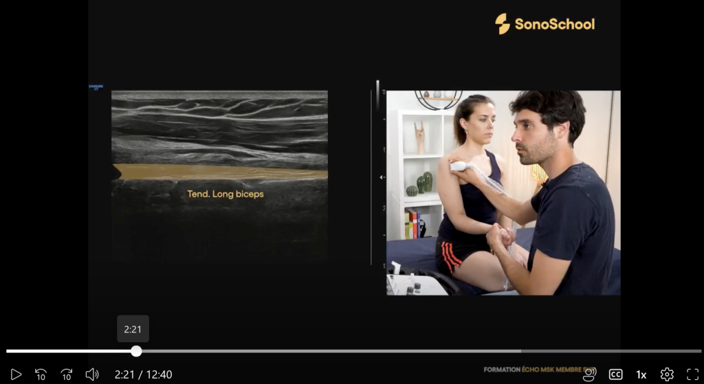 formation_echographie_epaule