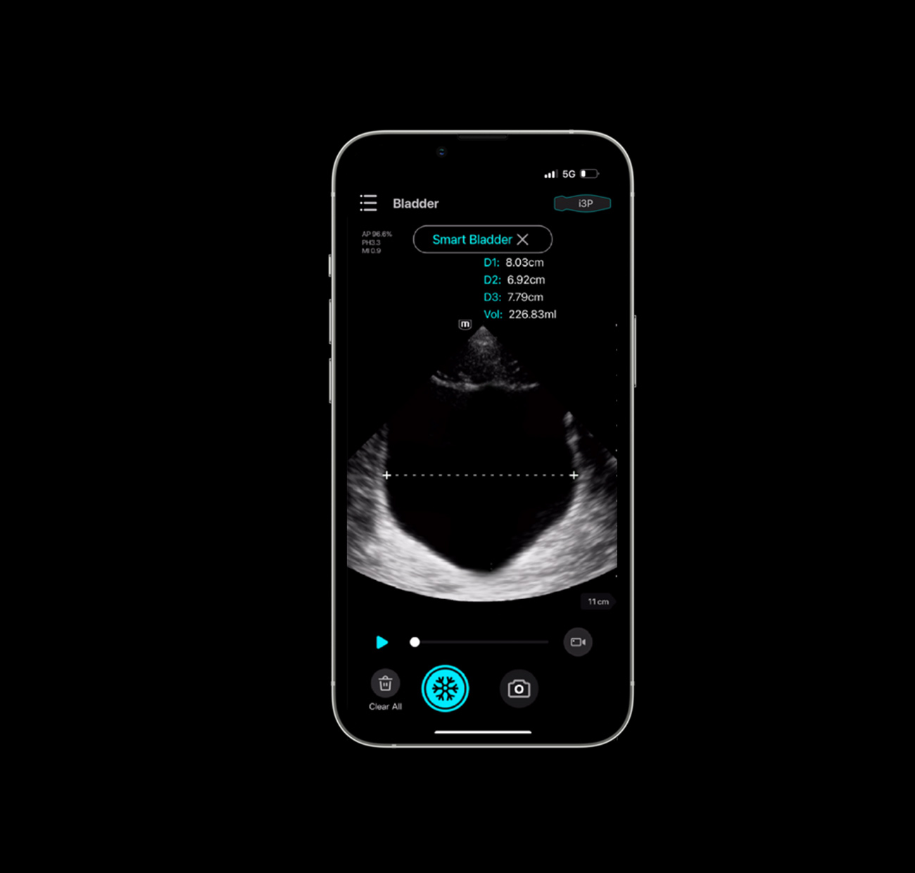 TE Air Smart Bladder (Vessie auto)