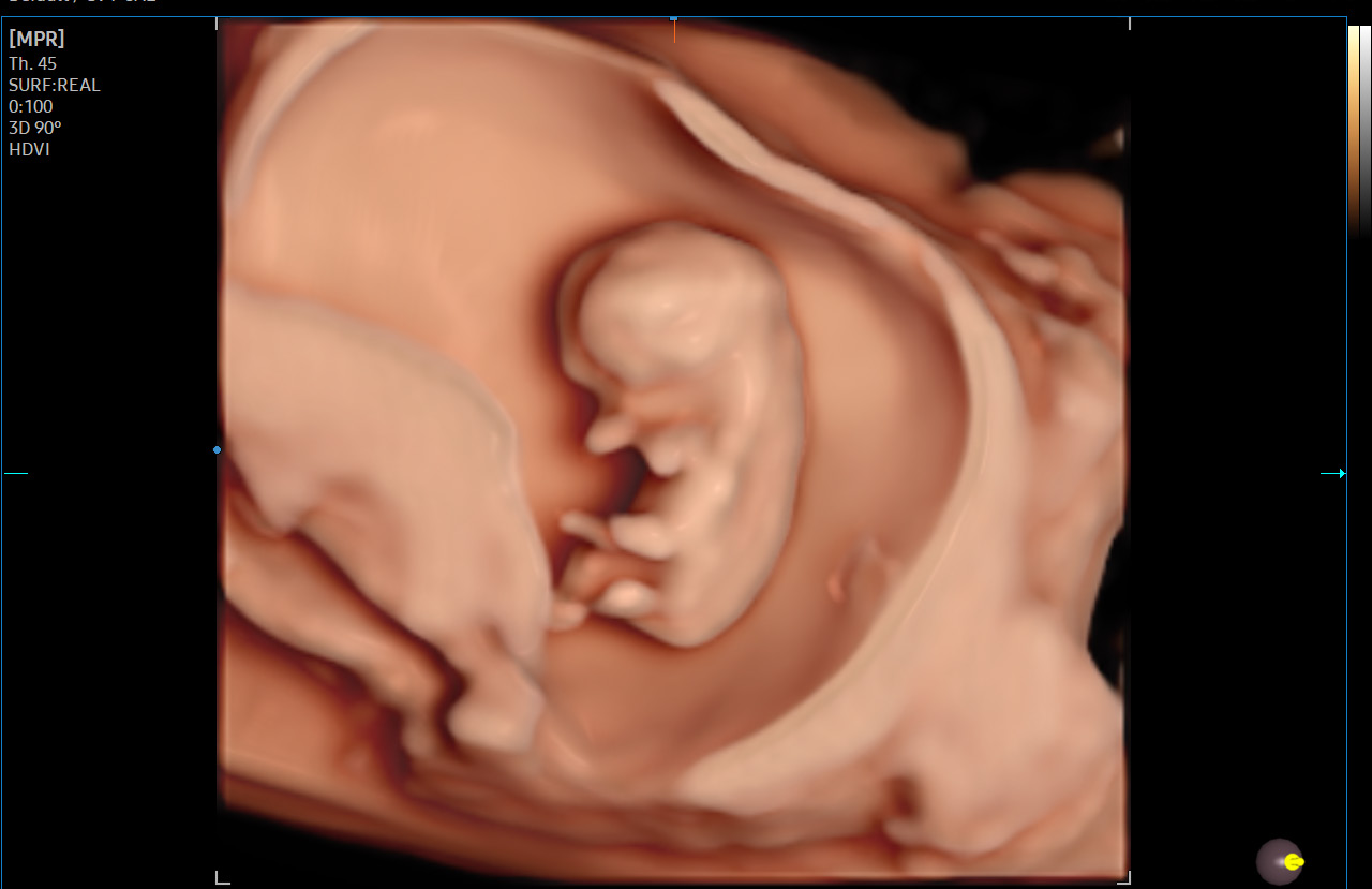 Embryon dans RealisticVue™1